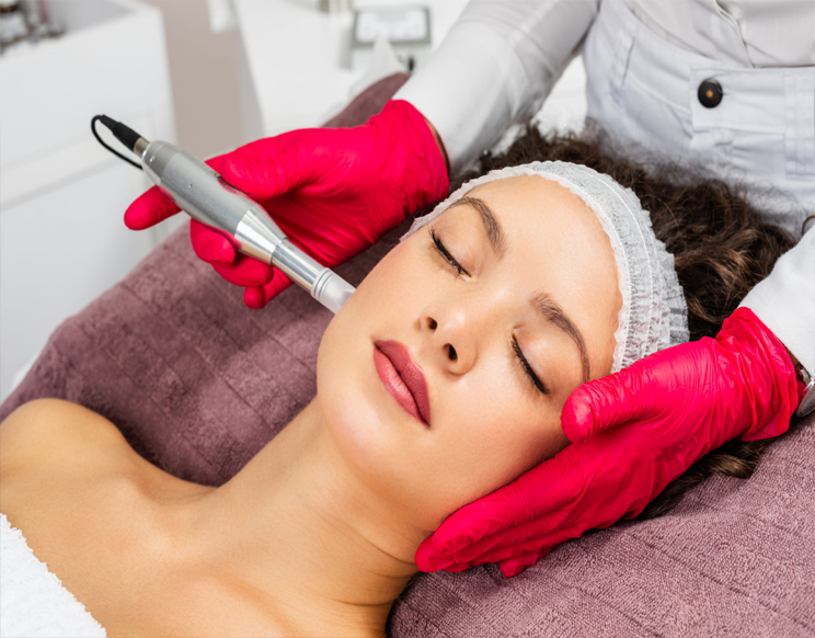 Micro Needling treatment
